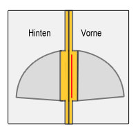 Tascheneingriff absteppen